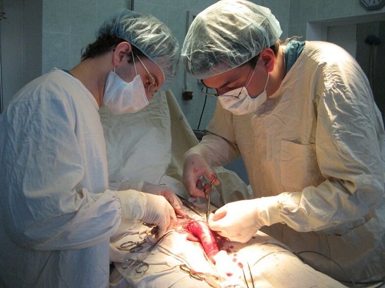 Performing ligamentotomy surgery to increase the length of the penis.